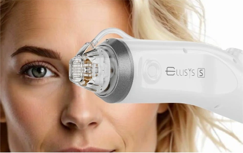 Микроигольчатый RF-лифтинг ELLISYS SENSE