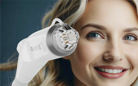 Безоперационная блефаропластика Sense Kiss